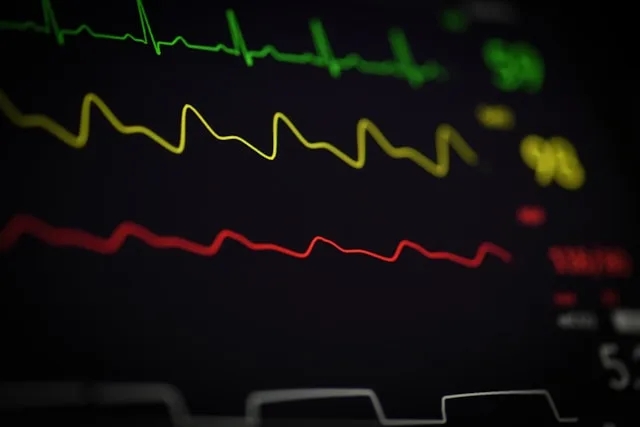 ECG waveforms on a monitor