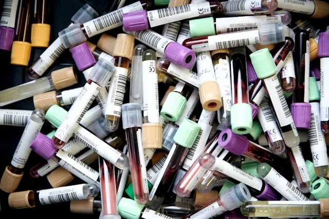 Blood samples in laboratory tubes